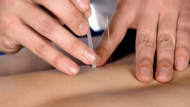 Acupuncture: A common remedy for low back pain