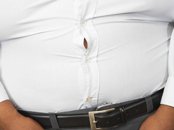 Complications of obesity Complications of obesity