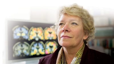 Alzheimer’s Disease
