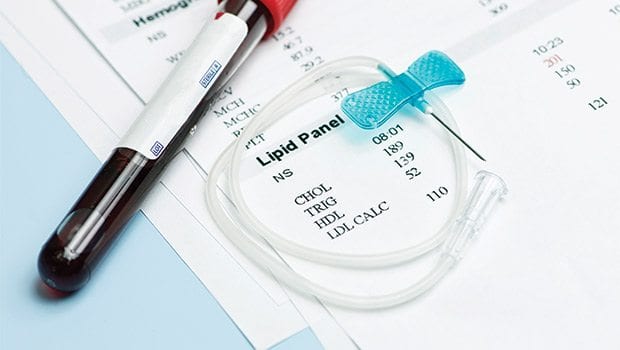 Screening tests for cholesterol Screening tests for cholesterol