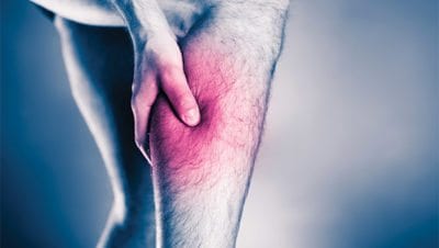 Peripheral arterial disease