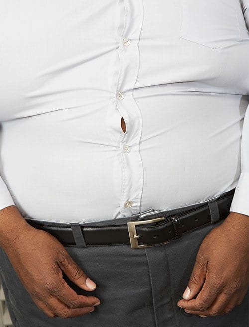 Prevalence of obesity: An upward curve Prevalence of obesity: An upward curve